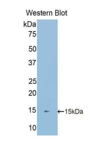 S100A16 Antibody (aa2-103)