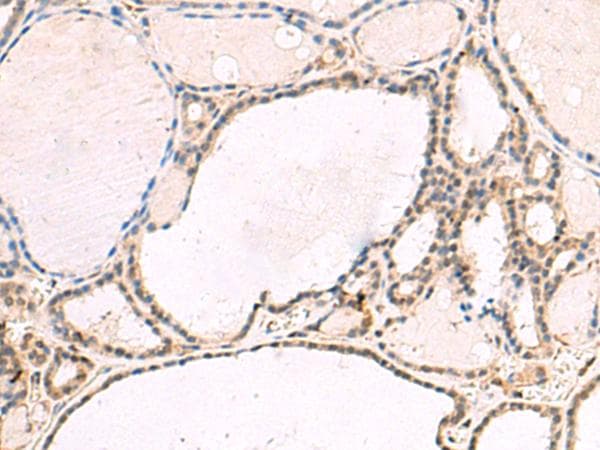 RNF13 Antibody