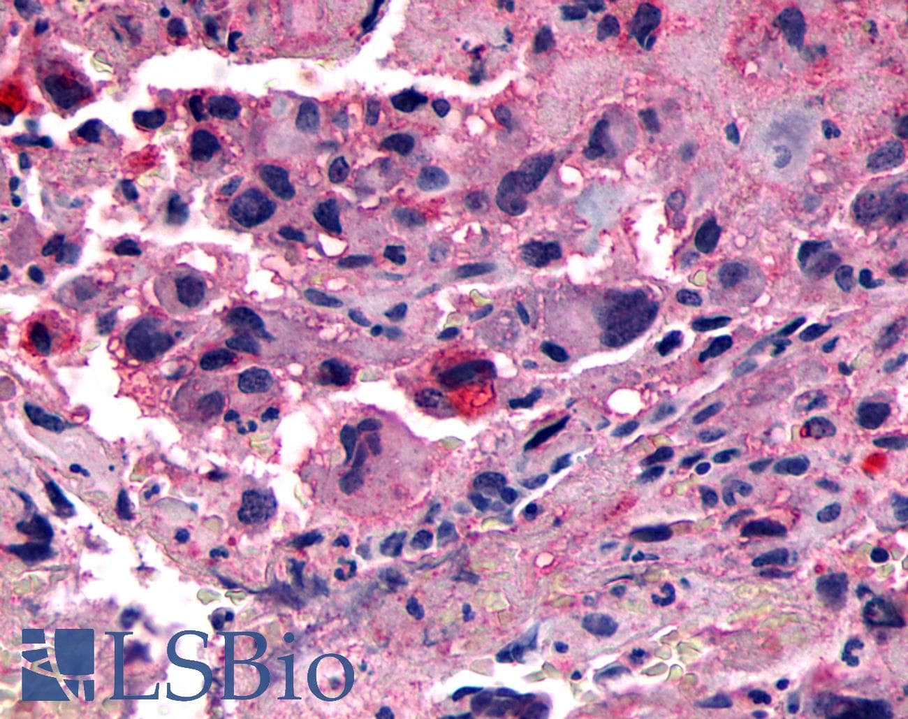 PathPlus™ Polyclonal Rabbit anti-Human CALCRL / CGRP Receptor Antibody (N-Terminus, IHC)