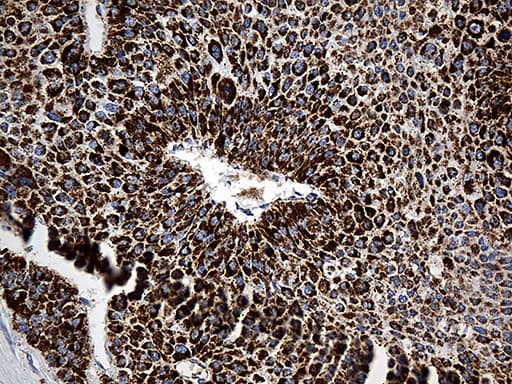 Monoclonal Mouse anti-Human CYP7B1 Antibody (clone OTI1G7, aa263-506, IHC, WB)