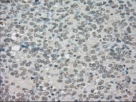 NTRK3 / TRKC Antibody (clone OTI24B3)