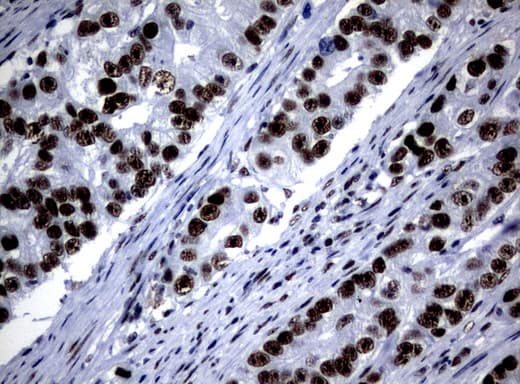NBN / Nibrin Antibody (aa461-754, clone UMAB99)