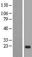 TTDN1 Protein (Over-Expression Lysate Myc-DDK (Flag))