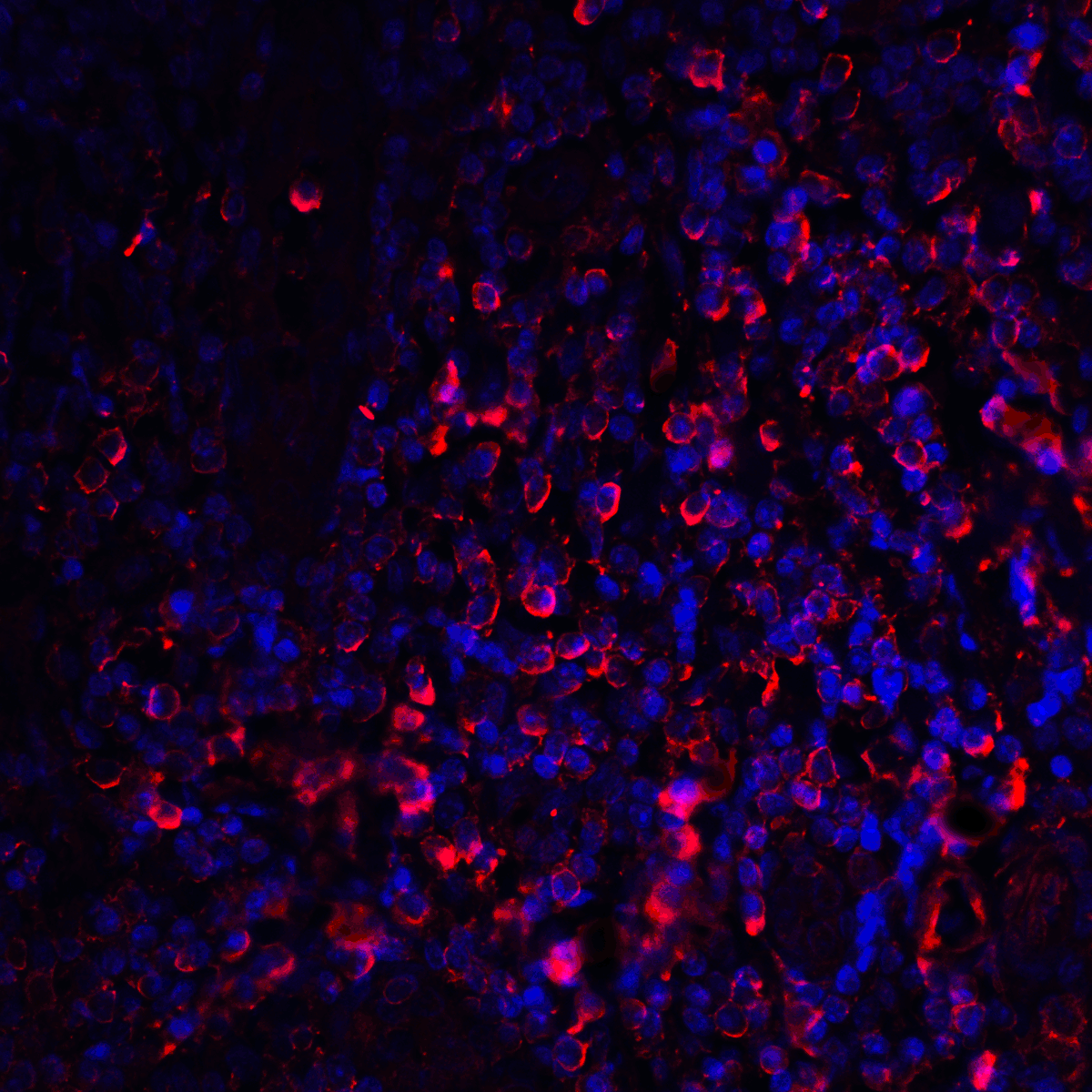 CTLA4 / CD152 Antibody (clone 1E6)