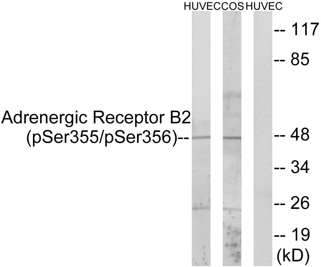 Polyclonal Rabbit anti-Human ADRB2 Antibody (phospho-Ser355/356, IHC, WB)