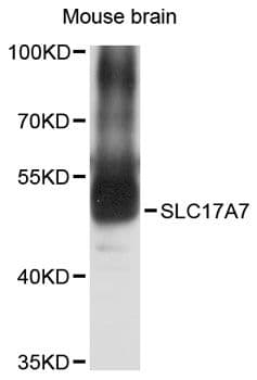SLC17A7 / VGLUT1 Antibody