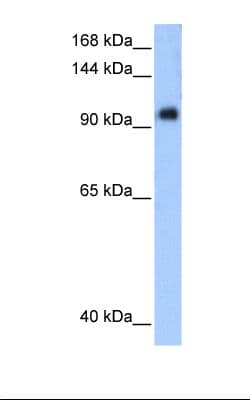 PPP1R13L / iASPP Antibody (aa501-550)
