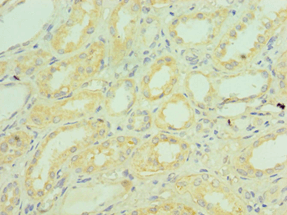 Complement C1QB Antibody (aa104-253)