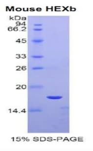 Mouse HEXB Protein (Recombinant His)