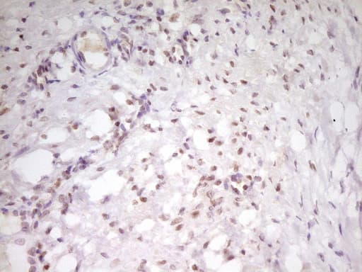 Monoclonal Mouse anti-Human ATF1 Antibody (clone OTI8G3, IHC, WB)