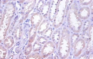 TRAIL-R4 / DCR2 Antibody