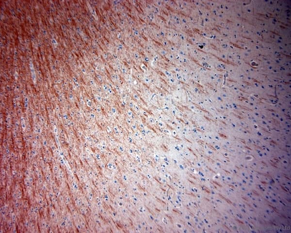 Polyclonal Rabbit anti-Human MBP / Maltose Binding Protein Antibody (aa180-220, IHC)