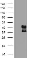 PDSS2 / DLP1 Antibody (clone OTI1D10)