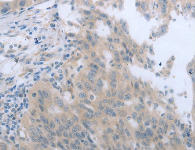 TNK2 / ACK1 Antibody