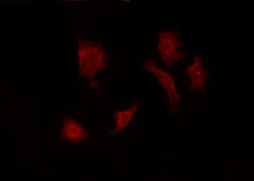FGF22 Antibody