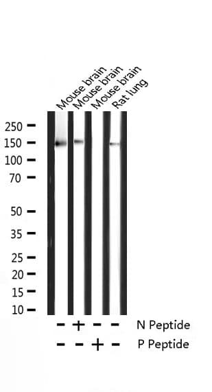 NTRK2 / TRKB Antibody (phospho-Tyr705)