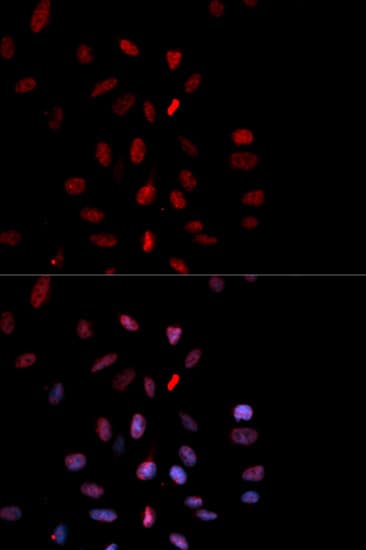 FOS / c-FOS Antibody (phospho-Thr232)