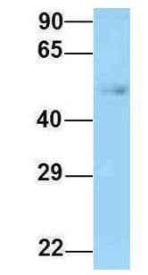 CCT2 / CCT Beta Antibody (aa89-138)