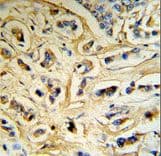Polyclonal Rabbit anti-Human Alpha-S1-Casein / CSN1S1 Antibody (aa42-70, IHC, WB)