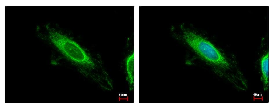 TBRG4 Antibody (aa1-270)