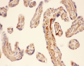 Polyclonal Rabbit anti-Human CMA1 / Mast Cell Chymase Antibody (aa22-247, IHC, WB)