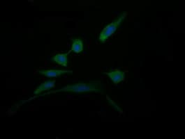DDT / Dopamine Tautomerase Antibody (clone OTI3A11)
