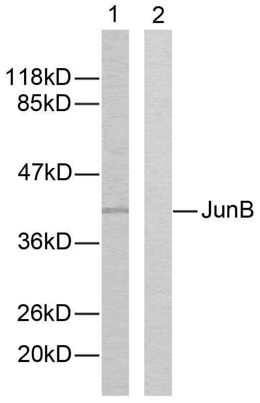 JUNB / JUN-B Antibody (p259)