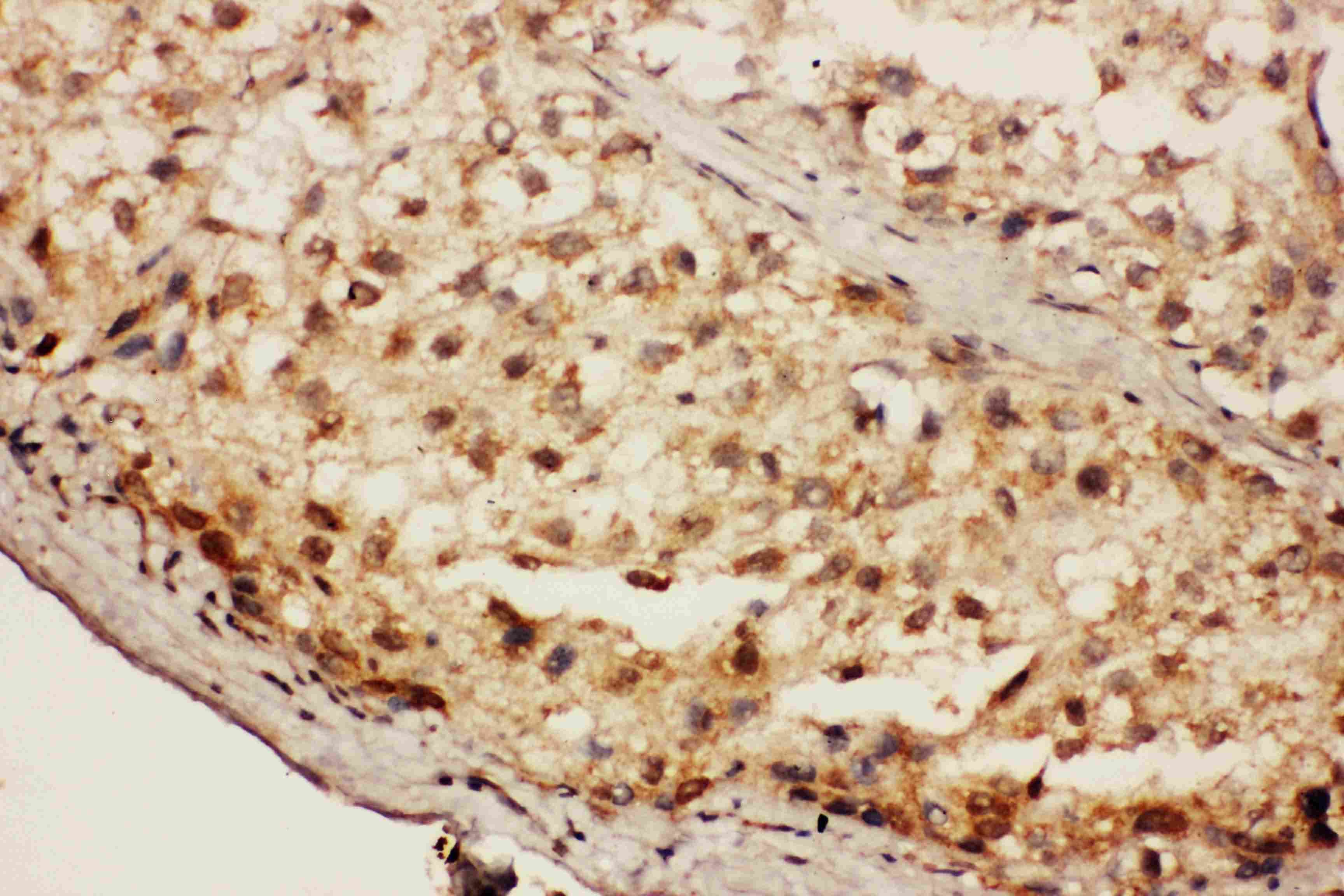 Polyclonal Rabbit anti-Human CACYBP Antibody (aa160-175, IHC, WB)