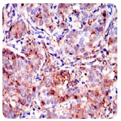 ANXA1 / Annexin A1 Antibody (aa100-300, clone 2F1)