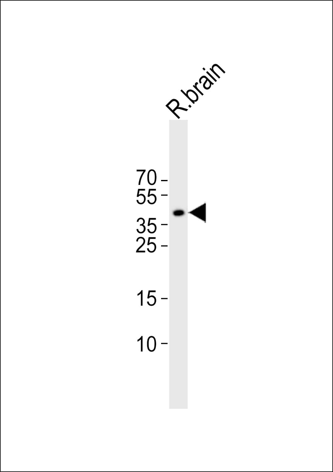 ISLET-1 / ISL1 Antibody (aa302-336)
