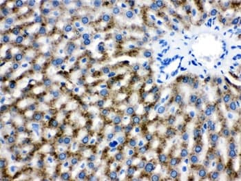 Polyclonal Rabbit anti-Human CAT / Catalase Antibody (IHC, WB)