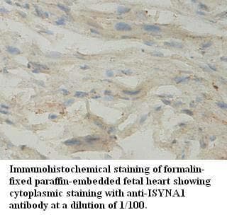 Polyclonal Rabbit anti-Human ISYNA1 Antibody (aa141-314, IHC, WB)