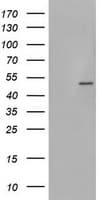 PHKG2 Antibody (clone OTI2E5)