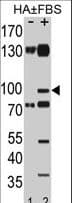 Polyclonal Rabbit anti-Human EPHA2 / EPH Receptor A2 Antibody (phospho-Ser897, WB)