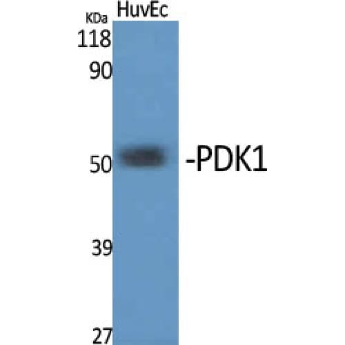 PDK1 Antibody (80-160 aa, Internal)