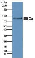 CFB / Complement Factor B Antibody (aa32-157)