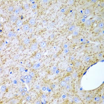 Polyclonal Rabbit anti-Human INHA / Inhibin Alpha Antibody (IHC, WB)