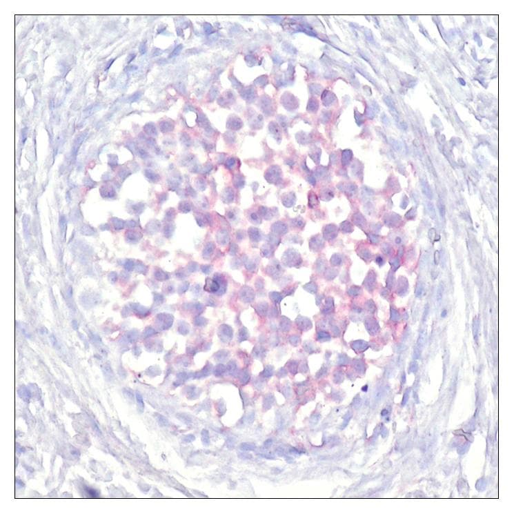 RAF1 / RAF Antibody (phospho-Ser259)