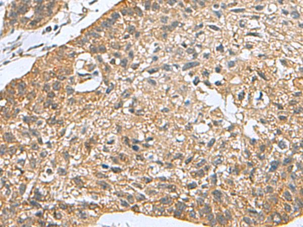 Polyclonal Rabbit anti-Human PDCD5 Antibody (IHC)