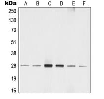 Polyclonal Rabbit anti-Human YWHAZ / 14-3-3 Zeta Antibody (phospho-Ser58, IHC, IF, WB)