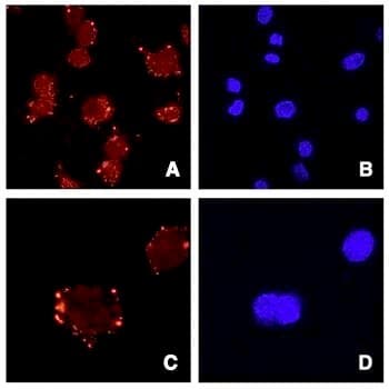 Polyclonal Goat anti-Human ASPN / Asporin Antibody (aa182-194, IF, WB)