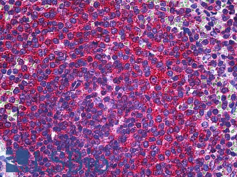 IHC-plus™ RALB Antibody (clone 4D1)