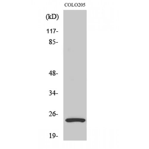 LYPLA1 Antibody (30-110 aa, Internal)