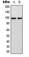 Polyclonal Rabbit anti-Human CDH17 / Cadherin 17 Antibody (Internal, IHC, WB)