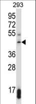 Polyclonal Rabbit anti-Human SUV39H1 Antibody (aa79-108, WB)
