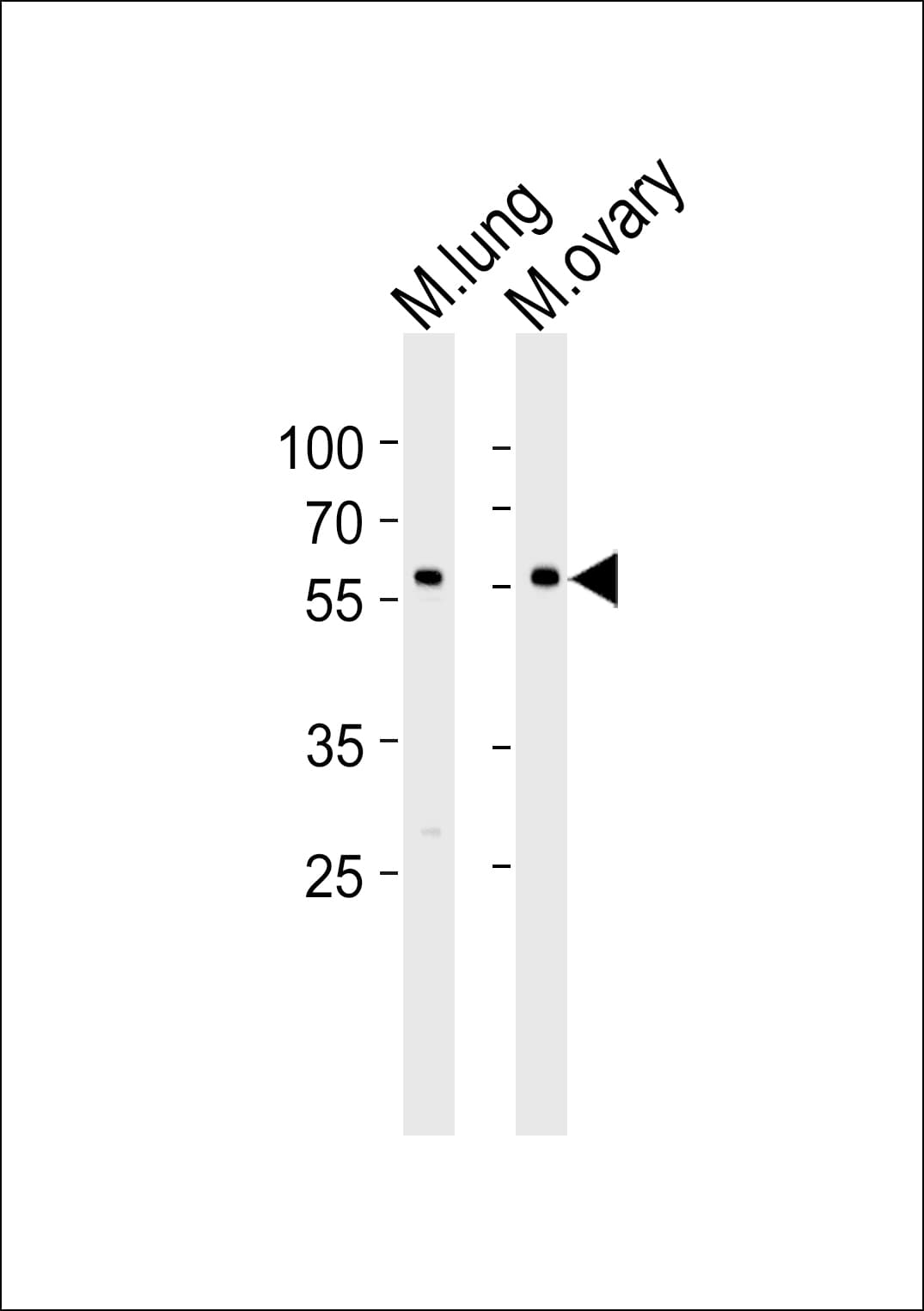 RYK Antibody (aa160-190)