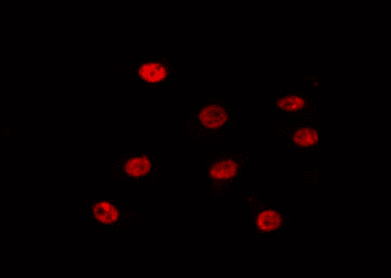 Polyclonal Rabbit anti-Human SIX1 Antibody (IF, WB)
