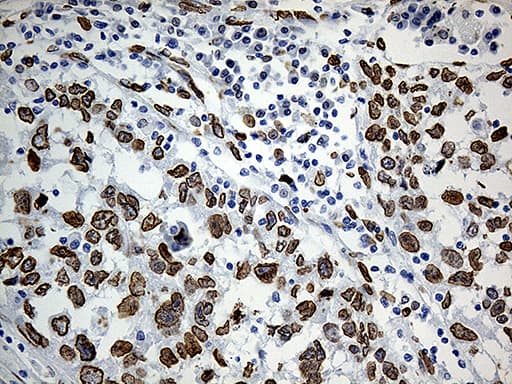 SLU7 / 9G8 Antibody (aa1-300, clone OTI5A7, Carrier-free)