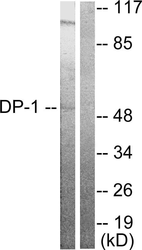 TFDP1 Antibody
