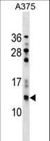 NGFRAP1 / NADE / Bex Antibody (aa14-42)